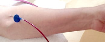 Bloodletting Berlin