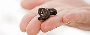 Medicinal Leech Therapy Berlin