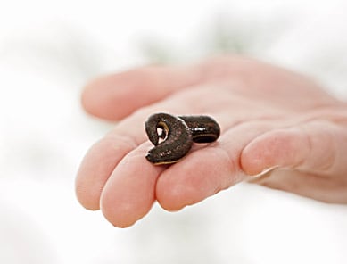 Medicinal Leech Therapy