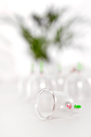 Cupping Therapy Berlin Potsdamer Platz